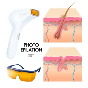 explications épilation laser